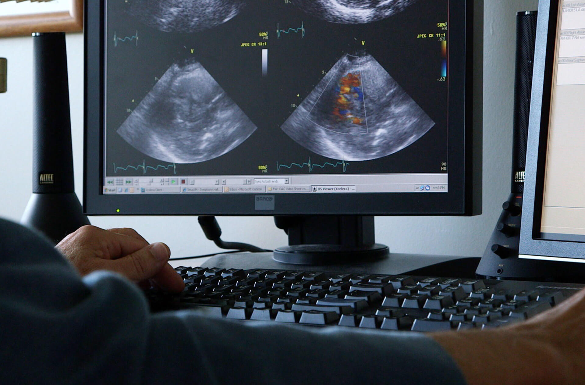 The OAC has been a long-time supporter of the Ontario’s echocardiography standards, maintained by Ontario Health – CorHealth Ontario, and the provincial Echocardiography Quality Improvement (EQI) Program, which accredits all echocardiography facilities in the province. OAC remains committed to working with all stakeholders to ensure that the program continues to [&hellip;]